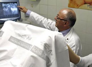 Conociendo el cáncer de cuello uterino Conociendo el cáncer de cuello uterino