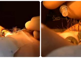 Implantes de joyería en los ojos ¿Te atreverías a todo por la moda? Implantes de joyería en los ojos ¿Te atreverías a todo por la moda?