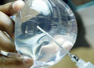 Los estados piden retirarse los implantes PIP usados para el aumento de mamas Los estados piden retirarse los implantes PIP usados para el aumento de mamas