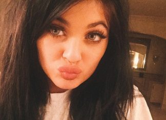 Conoce la nueva y peligrosa tendencia de labios inspirada en Kylie Jenner