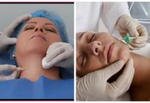 Cuida la piel de tu cuello y papada con la carboxiterapia