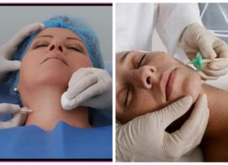 Cuida la piel de tu cuello y papada con la carboxiterapia