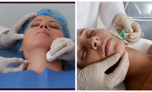 Cuida la piel de tu cuello y papada con la carboxiterapia