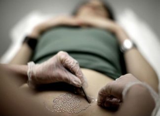 Aprende estos prácticos consejos si planeas realizarte la depilación brasileña