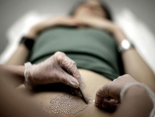 Aprende estos prácticos consejos si planeas realizarte la depilación brasileña