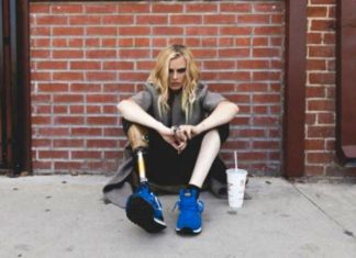 Conoce la historia de la modelo de Vogue que perdió una pierna por usar tampones